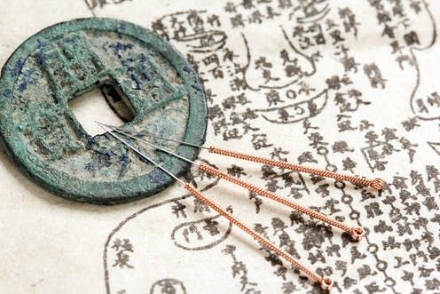 “Demystifying Acupuncture: A Comprehensive Guide to Understanding this Ancient Healing Art”